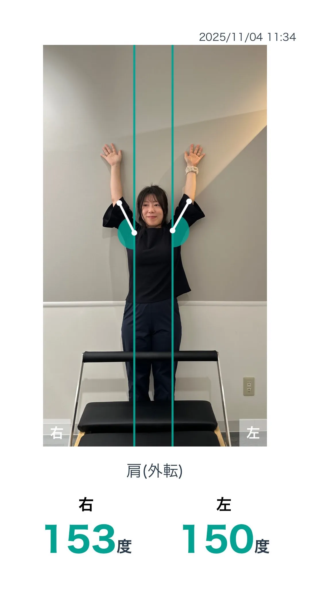 施術後 肩の可動域