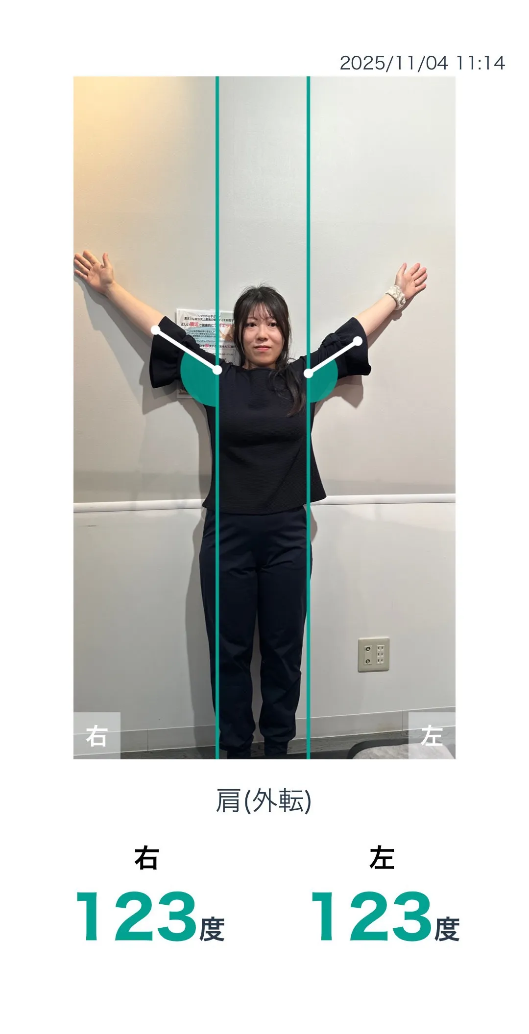 施術前 肩の可動域