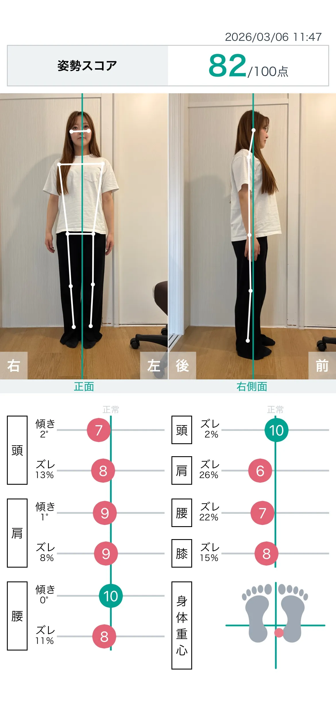 施術後 姿勢スコア