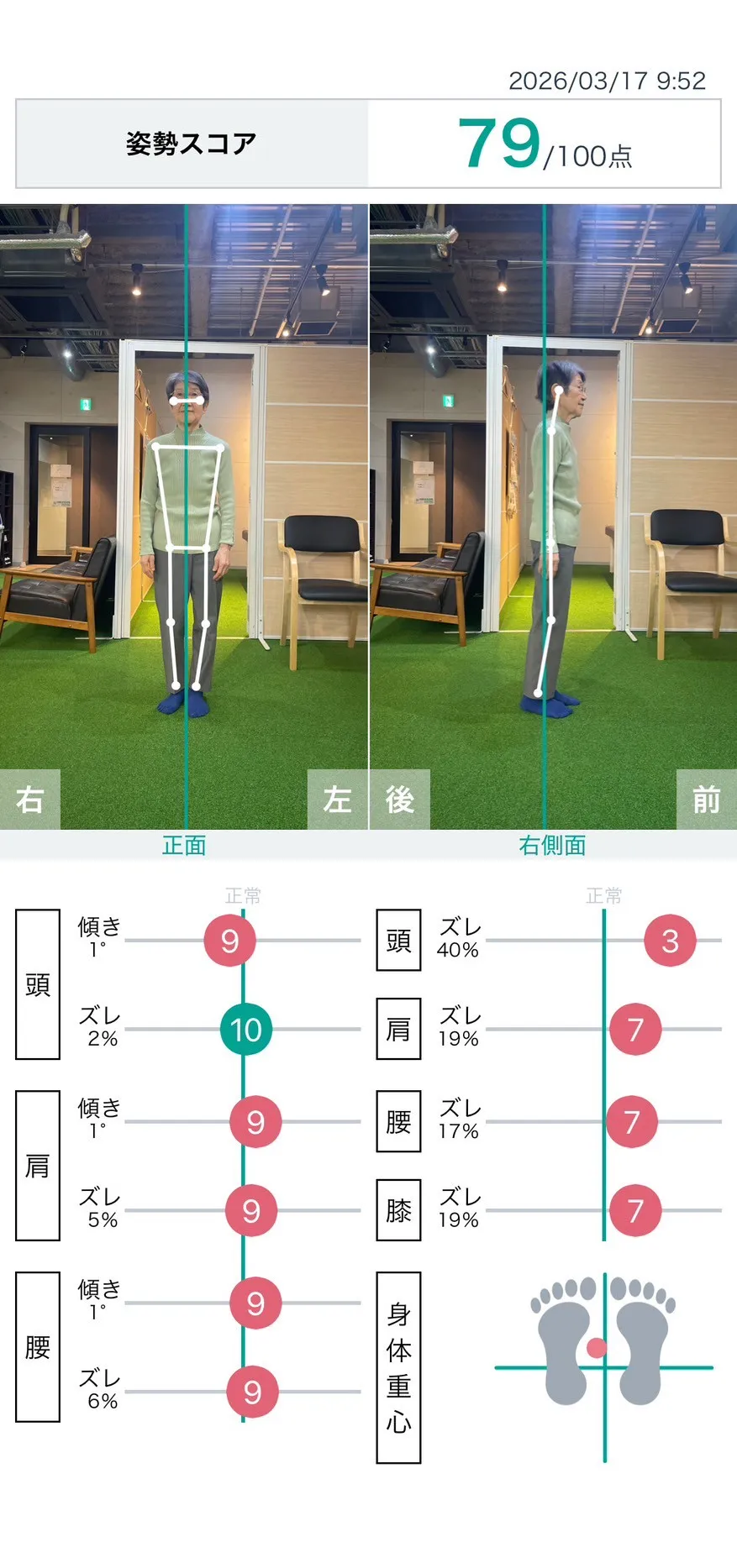 施術前 姿勢スコア