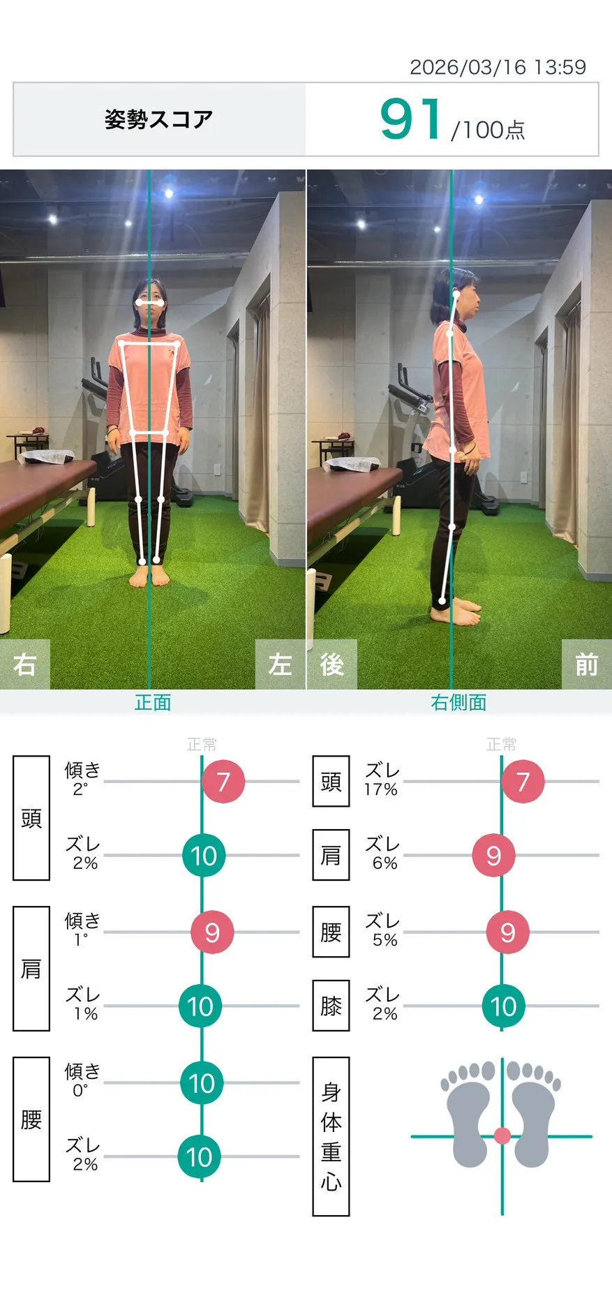 施術後 姿勢スコア