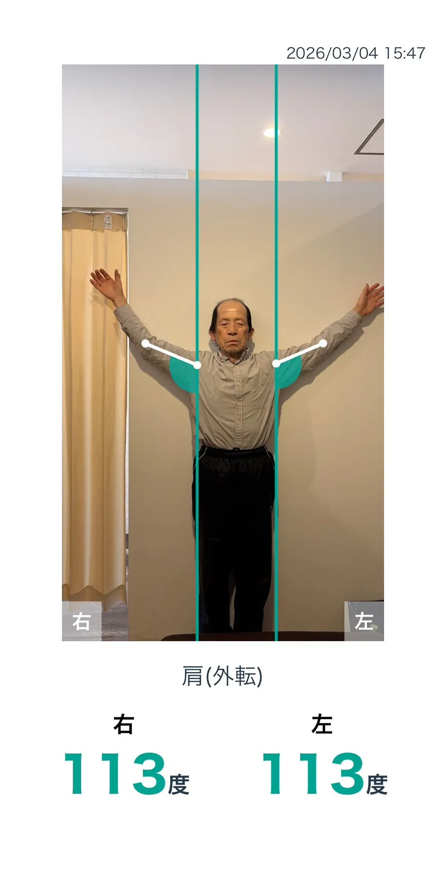 施術後 肩の可動域