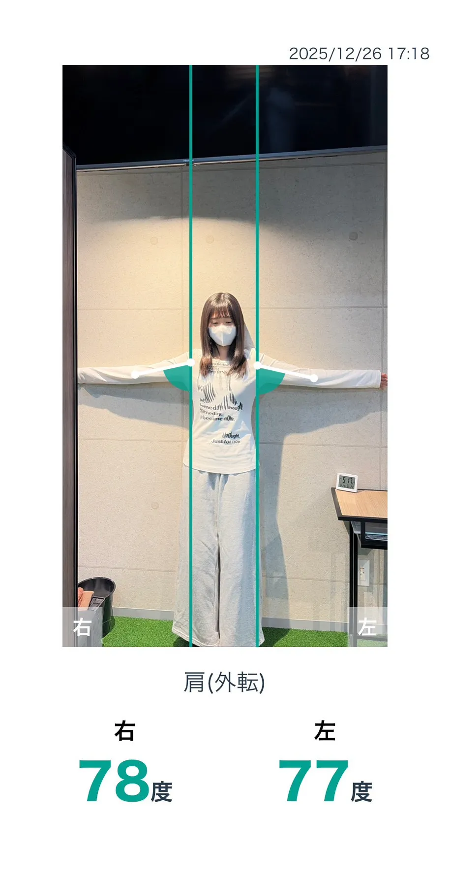 施術前 肩の可動域
