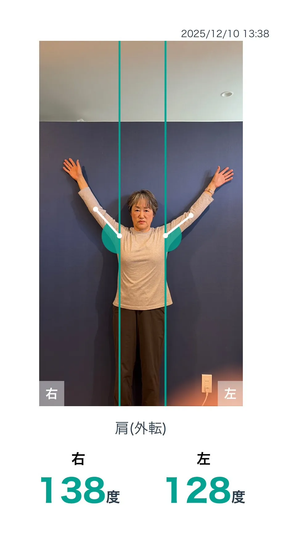 施術後 肩の可動域