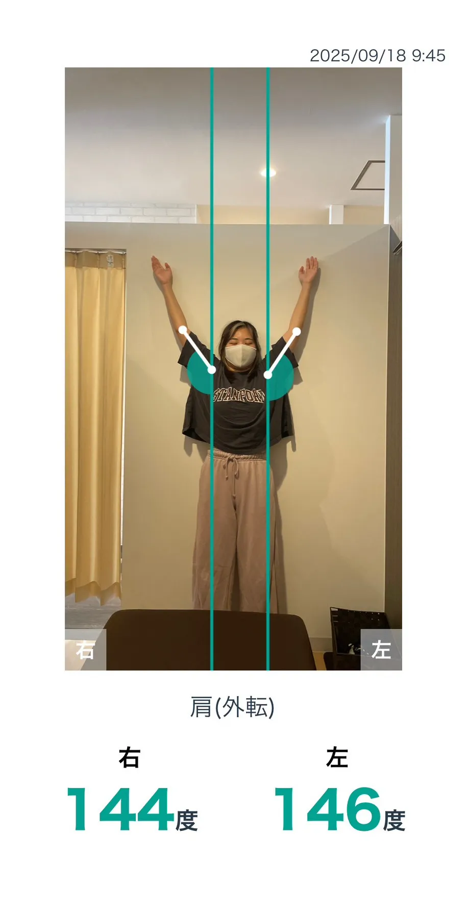 施術後 肩の可動域