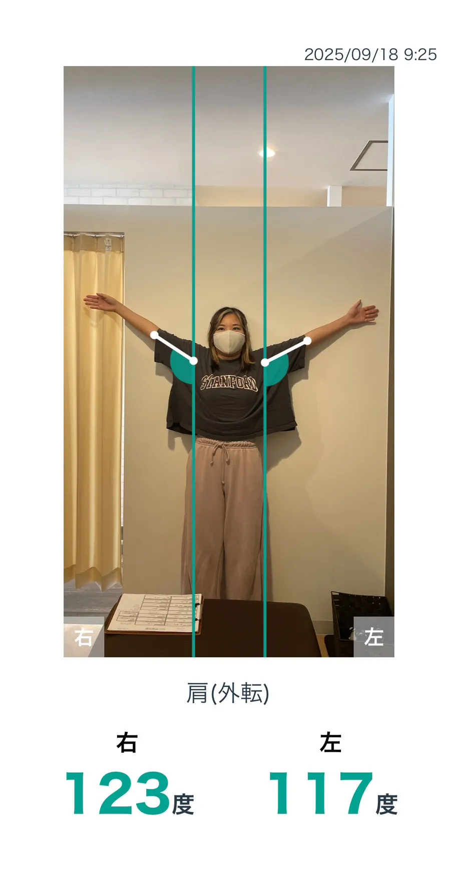 施術前 肩の可動域