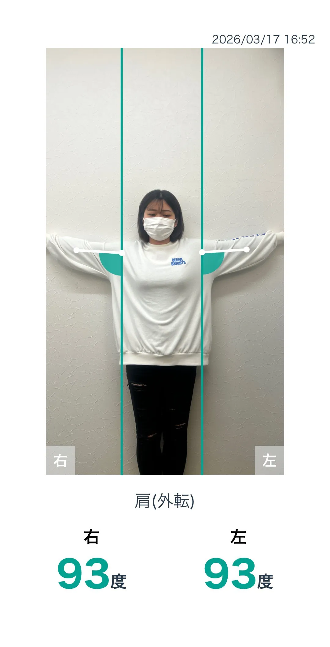 施術前 肩の可動域